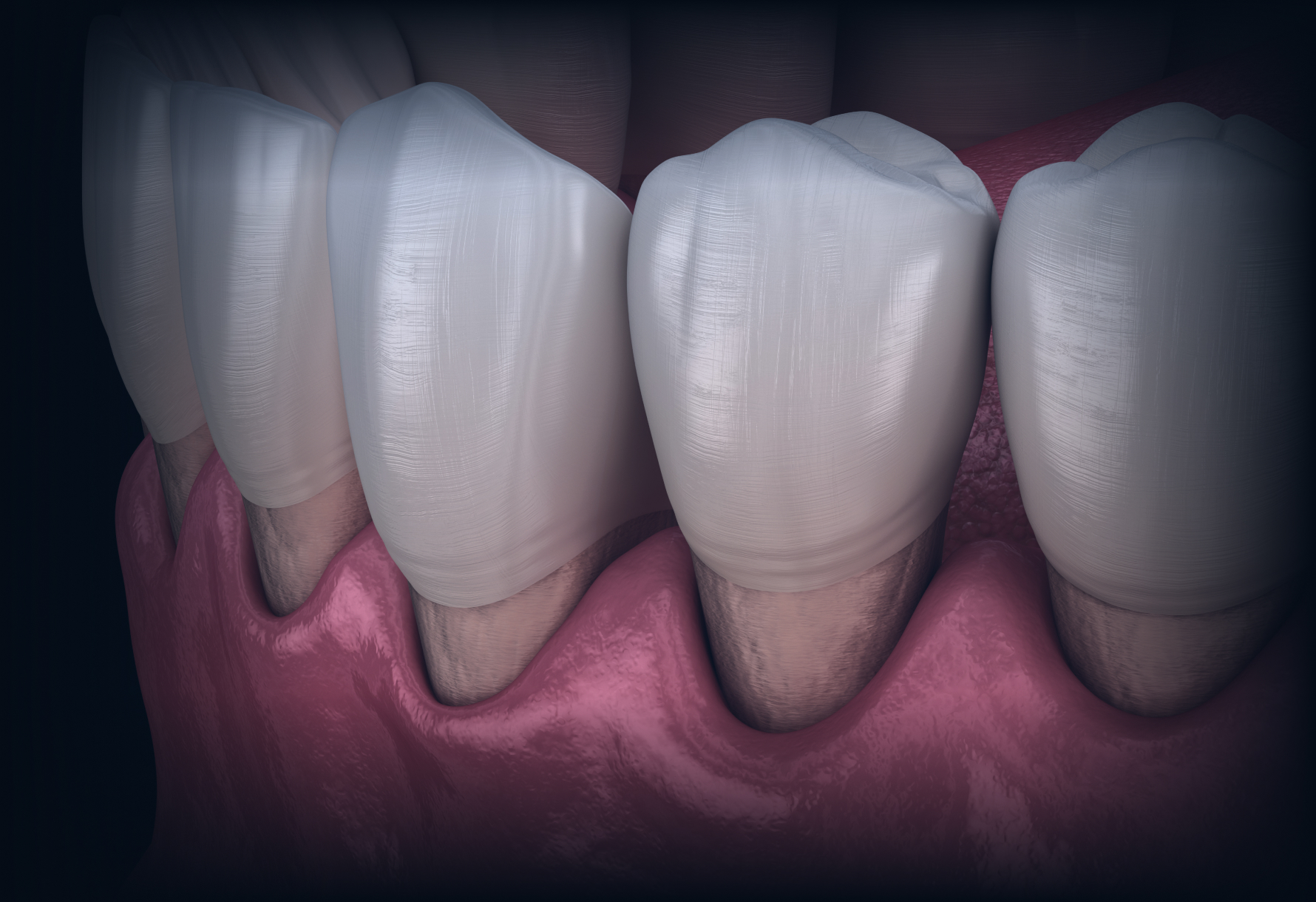 気づかないうちに進行しているかも...あなたのお口の感染症